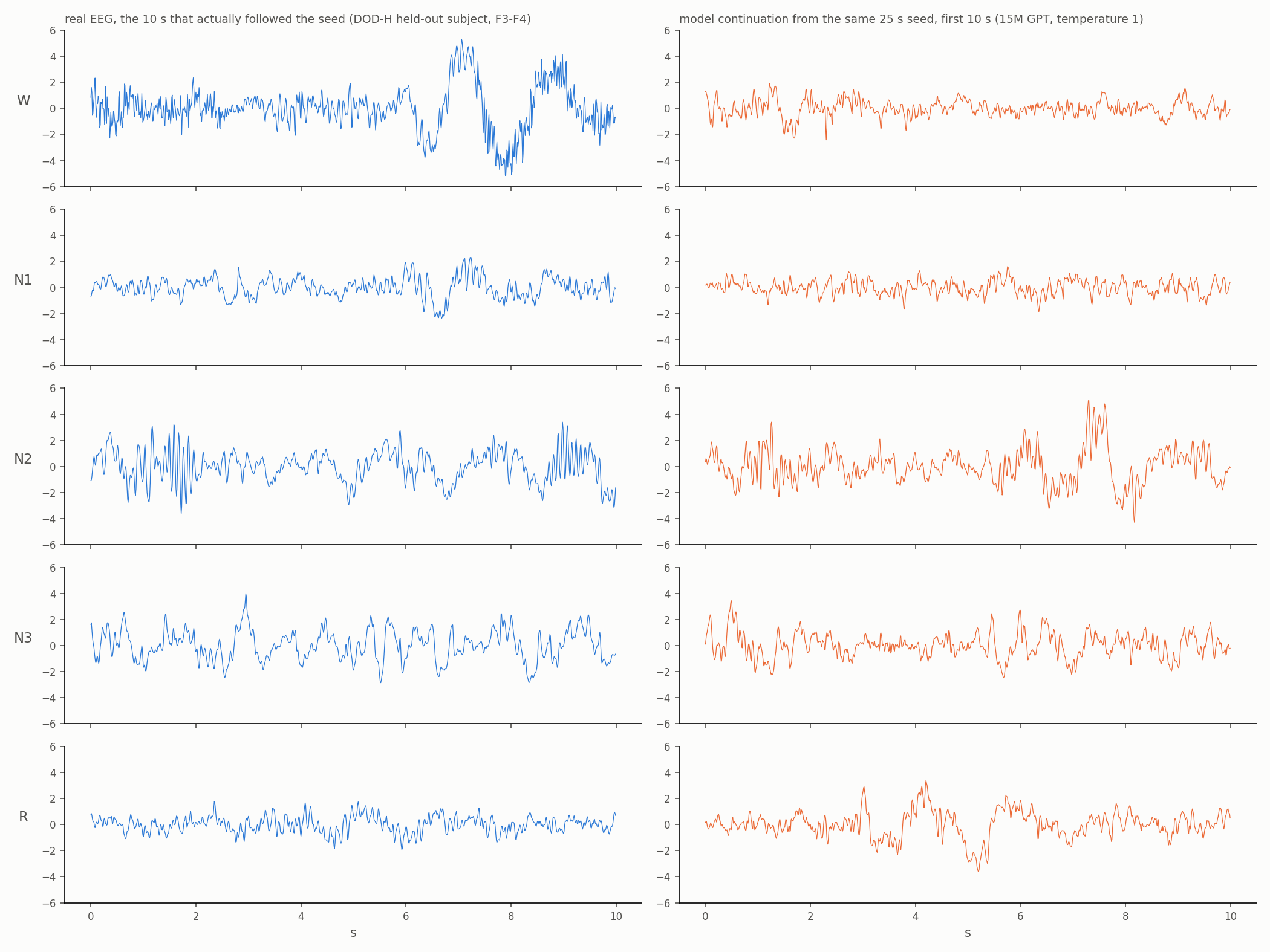 real versus generated EEG by stage
